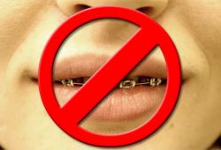 Tips on Kissing with Braces image
